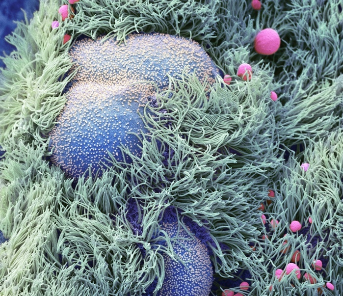 Bronchial epithelium, SEM Bronchial epithelial culture, coloured scanning electron micrograph  SEM . HAE  Human airway epithelial  cultures are derived from primary bronchial epithelial cells isolated from the airways of human lung donors or patients undergoing lung transplantation, and have been used extensively to study the biology of respiratory epithelium. The primary cells then replicate and differentiate into the pseudostratified epithelial morphology found in the airway. Mature differentiated HAE cultures can be maintained for up to two months and contain mucous producing goblet cells  mucous red  and non ciliated  blue  and ciliated epithelial cells  cyan , and have been shown to be ideal for propagation of a wide range of human respiratory pathogens, including influenza virus. Mag: x 2700 at 10cm. Specimen courtesy of the influenza research group, Professor Wendy Barclay Imperial College London, UK Photo by STEVE GSCHMEISSNER SCIENCE PHOTO LIBRARY