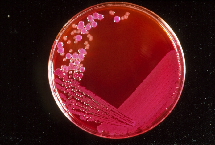 Photograph of petri dish cultures growing mixed colonies of Escherichia coli, (larger, pink) & Proteus vulgaris, (smaller, brown), both bacteria, which under normal circumstances harmlessly inhabit the human intestines. They are generally involved in digestion - E. coli specifically fermenting lactose. They can, however, both become pathogenic; E. coli causing infections of the urinogenital tract, Proteus vulgaris of the urinary tract. The latter bacterium is also associated with decaying organic matter. E. coli is the most researched bacterium, the knowledge from which has lead to many of the advances in genetic engineering & biotechnology.