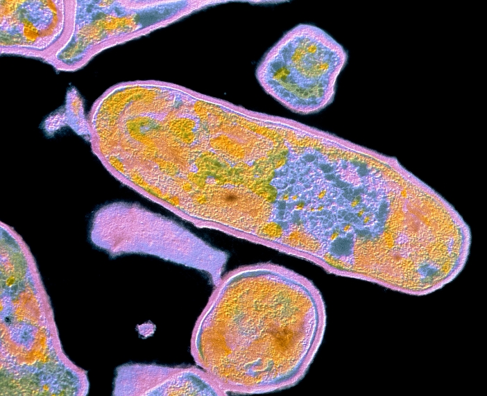 False-colour transmission electron micrograph (TEM) of Corynebacterium diphtheria, showing a number of the Gram-positive, non-sporing, aerobic bacilli (rod-shaped bacteria) which are the causative agents of diphtheria. C. diphtheria is an obligate human parasite - man is its only natural host - causing an infection of the upper respiratory tract. Other effects arise from the production of an exotoxin which enters the bloodstream and damages the heart, nervous system, liver, kidneys and adrenal glands. The bacilli are slightly curved, and their appearance has earned them the name of 'chinese characters'. Mag: x13,000 at 35mm size, x26,000 at 6x7cm size.