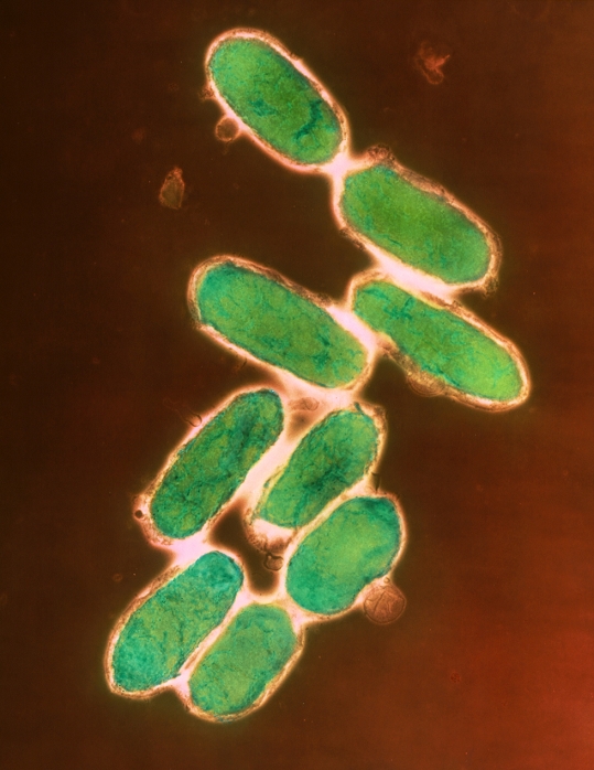 False-colour transmission electron micrograph of Yersinia pestis, the bacterium which causes bubonic plague (the Black Death of the Middle Ages). The bacterium is primarily a flea-carried pathogen of rats. Transfer to man occurs when a flea is obliged to leave its dead rodent host and feed on human blood. Infection is rapid, causing swellings in the lymph nodes (buboes) and leading to septicaemia & pulmonary infection. Extensive control measures, directed against the rats as well as their fleas, have essentially banished the plague from Europe, but there are still many regions of the world where the disease occurs. Magnification:x24,000 at 8x10inch,x6,857 at 6x7cm.