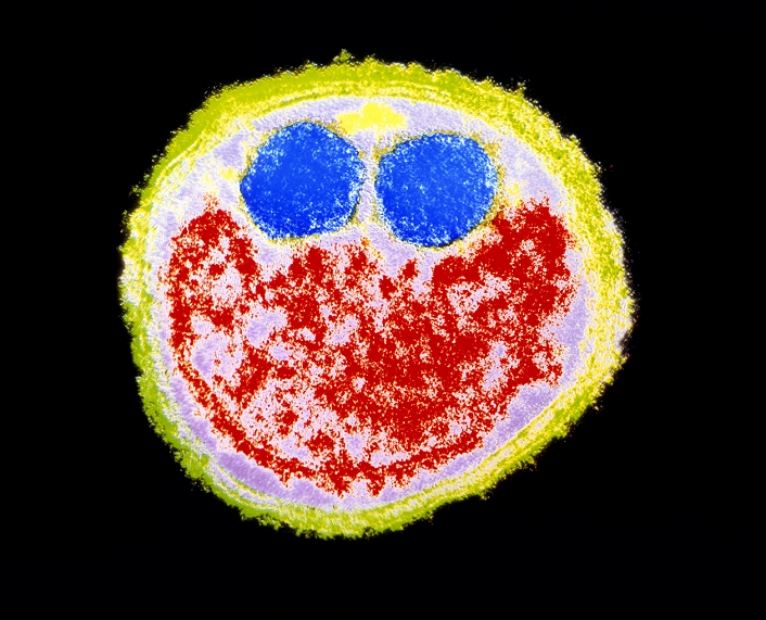 Coloured transmission electron micrograph (TEM) of a transverse section through a Fusobacterium nucleatum bacterium. In this section the internal structures of the cell resemble a 'face': the 'eyes' (blue) are intracellular granules; the 'mouth' (red) contains cytoplasm and is shaped by a cell membrane. Many such membranes make up the cell wall. Fusobacterium nucleatum typically are long, anaerobic, rod-shaped bacteria, tapered at both ends. They occur in the dental plaque that forms on the surface of teeth. These bacteria ferment carbohydrates to lactic acid; plaque is a cause of periodontal disease and tooth decay in humans. Magnification: x67, 200 at 6x4.5cm size.