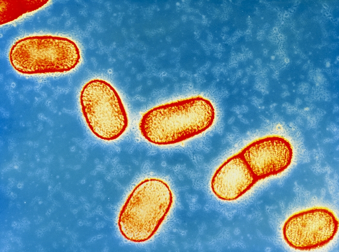 Coloured transmission electron micrograph of the bacteria Bacteroides gingivalis (formerly Bacteroides melaninogenicus asaccharolyticus). These Gram-negative, anaerobic bacteria are rod- shaped cocco-bacilli. In this shadow preparation technique, the surface of the bacterial cell wall is seen. B. gingivalis is associated with gingivitis (gum disease) and other periodontal infections including mouth abscesses. It is not confined to the mouth and may infect other regions of the body. In humans it also occurs as normal harmless flora in the mouth, intestine and urogenital tract. Magnification: x7680 at 6x4.5cm size.