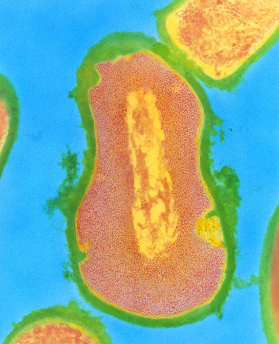 Propionibacterium acnes. Coloured transmission electron micrograph of a Propionibacterium acnes bacterium, in cross-section. It is associated with acne in humans. Formerly known as Corynebacterium acnes, it is a rod-shaped Gram-positive bacillus. The cell's genetic material is seen at centre (yellow). P. acnes is a part of the human skin microflora which breaks down lipid components of sebum. This bacteria is not found in children; colonization occurring at puberty and peaking around 16-17 years old. High numbers of P. acnes are thought to cause the inflammatory response of acne. Treatment is with tetracycline drugs. Magnification: x53,000 at 6x7cm size. x180,000 at 8x10ins