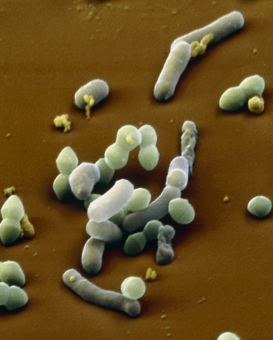Lactobacillus bacteria. Coloured scanning electron micrograph (SEM) of Lactobacillus sp. bacteria (grey/blue). Unidentified spherical cocci (green) are also seen. Both types of bacteria are an important constituent of the oral and intestinal flora, fermenting glucose to lactic acid. For this reason they are used extensively in the food industry, for the preparation of milk products and sauerkraut among other foods. These bacteria are a cause of tooth decay. If too much sugar is consumed in the diet the excess lactic acid produced by them can damage tooth enamel. Magnification: x12,000 at 6x7cm size.