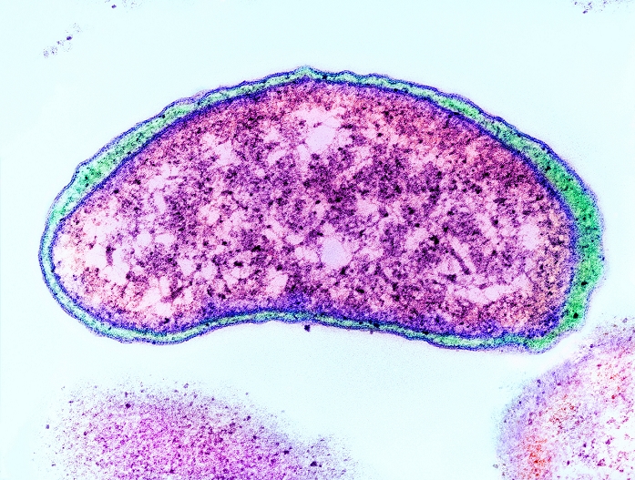 Vibrio cholerae bacterium, coloured transmission electron micrograph (TEM). This bacterium causes cholera, an infection of the small intestine. The outer membrane (outer blue line) and cytoplasmic membrane (inner blue line) are seen. This gram- negative bacterium grows up to 0.8 micrometres in length. It is a water-borne pathogen, which is transmitted to humans in contaminated food and water. It produces a toxin that causes diarrhoea and extreme dehydration, which may be fatal if untreated. Outbreaks are associated with poor sanitary conditions and are often epidemic. Magnification x40,000 at 5x7cm size.