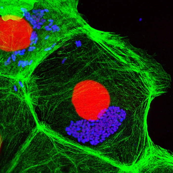 E. coli and Shigella sp. bacteria. Fluorescence confocal light micrograph of Escherichia coli and Shigella sp. bacteria (blue) in human Caco-2 cells (green), a cultured cell line derived from a colorectal carcinoma. The cell nuclei are red. These are motile bacteria that are capable of entering intestinal cells (enteroinvasive) and causing disease. Shigella sp. bacteria cause dysentery, which can vary in severity from a mild attack of diarrhoea to an acute infection. Enteroinvasive E. coli cause severe diarrhoea that can be fatal, especially in the very young or elderly.