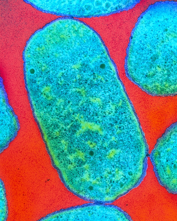 Pathogenic Escherichia coli O 111  Date and time of photograph unknown   E. coli O111 bacteria. Coloured transmission electron micrograph  TEM  of a section through Escherichia coli O111 bacteria. These are enterohaemorrhagic E. coli  EHEC , a dangerous form of the normally harmless E. coli bacteria which live in the human intestine. Usually transmitted though contaminated food, they can cause life threatening diarrhoea, intestinal bleeding, kidney failure and disturbances to blood clotting. There are no effective cures for EHEC, but there are treatments for dealing with the symptoms of infection. Another strain of EHEC bacteria is E. coli O157:H7. Magnification: x47,000 at 6x7cm size. Magnification: x160,000 at 8x10 ins size.