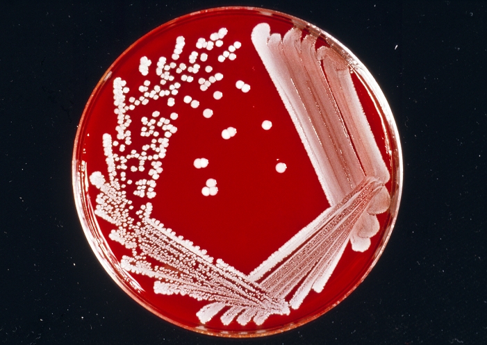 Photograph of a petri dish culture of the bacteria Staphylococcus aureus (pyogenes) (2 strains) after 24 hours growth on blood agar. This bacteria is found on healthy human skin and mucous membranes, but is responsible for pus containing infections such as boils, abscesses & wounds generally. The infection occurs when the bacteria enter the body through a hair follicle or a break in the skin, releasing toxins and causing the breakdown of tissue (necrosis). The individual organism is spherical, nonmotile and occurs in grapelike clusters.