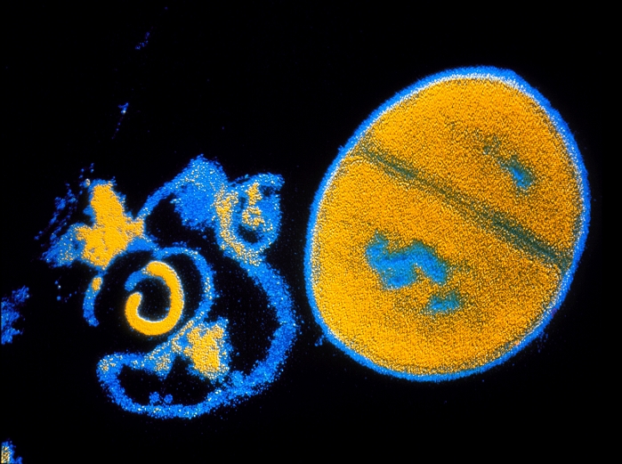 False-colour transmission electron micrograph (TEM) showing the effect of an antibiotic on the bacterium Staphylococcus aureus. On the left are the remains of a bacterium destroyed by lysis (bursting); the bacterium at right is, as yet, undamaged and is in the process of dividing. Lysis is achieved by the destruction of the outer cell wall and the subsequent release of the intracellular contents into the surrounding medium. S. aureus is a Gram-positive species of bacteria that is the commonest cause of pyogenic (pus-forming) infections in humans. It has evolved a number of variants resistant to antibiotics. Magnification: x37,000 at 6x7cm size.