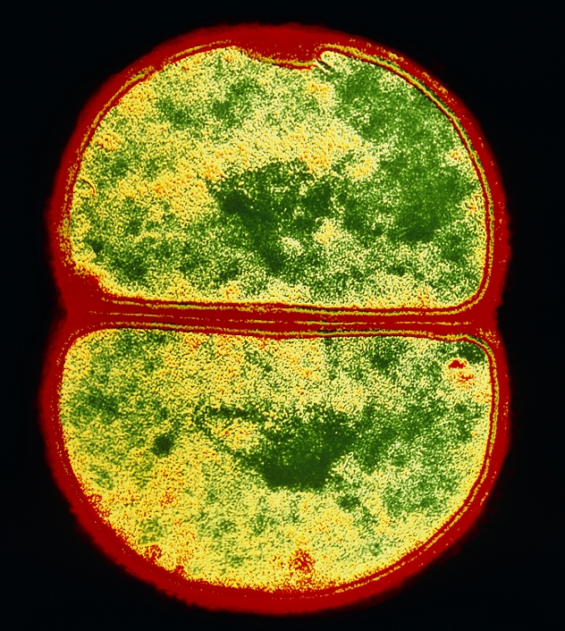 False-colour transmission electron micrograph of the spherical bacterium Staphylococcus aureus in the process of cell division. The cell walls (red) are visible, forming two daughter cells. A dark green clump of genetic material is present in each cell. S. aureus are gram-positive bacteria which are commonly found on healthy human skin & mucous membranes, such as the lining of the mouth. They may, however, cause boils, usually by entering through a hair follicle or a break in the skin. They are also responsible for internal abscesses & any acute suppurative infection. They are commonly found in grape-like clusters. Magnification: x57,000 at 6x6cm size.