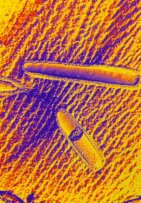 Heat-loving bacteria. Coloured freeze-fracture transmission electron micrograph (TEM) of the hyperthermophilic (very high temperature-loving) bacteria, Thermoproteus tenax. Two rod-shaped bacterial cells are seen, freeze-fractured to show the lattice-like cell wall. Extremophile bacteria live in extreme conditions, such as extremes of temperature, pH, pressure, and salt environments. T. tenax is an organism that belongs to the Archaea group (primitive bacteria). It is found growing in hot springs surviving temperatures of up to 96 degrees Celsius, and living & growing optimally at 88 degrees Celsius. Magnification: x11,300 at 5x7cm size.