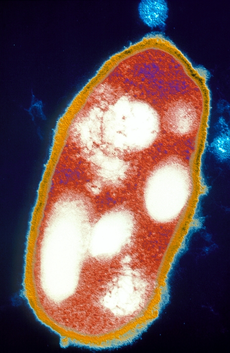 Haloferax mediteranei bacterium. Coloured transmi- ssion electron micrograph (TEM) of a section thro- ugh an extremophile Haloferax (or Halobacterium) mediteranei bacterium. It is a Gram-negative, non- motile aerobic bacillus (rod-shaped bacterium). It occurs in highly saline environments such as salt lakes or evaporation ponds. They may also be found on the surfaces of heavily salted foods, usually fish and meat, and can cause spoilage. Colonies of the bacteria are red in colour. Some strains can use their pigments to harness light energy when under low oxygen levels. Due to their high demand for salts, Haloferax sp. are not pathogenic in humans. Magnification: x12,500 at 6x9cm size.