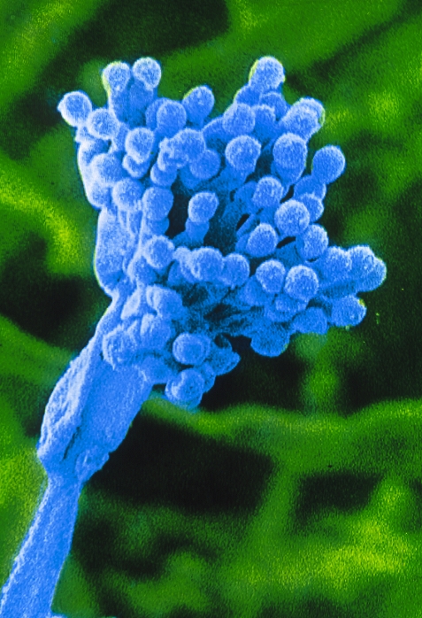 A type of blue green mold  Date of photograph unknown  False colour scanning electron micrograph of the fruiting body of an unidentified species of Penicillium. The tiny, spherical spores  conidia  are borne at the tip of a specialised erect hypha, known as a conidiophore. Magnification: x11,500 at 5x7cm size. x 11,500 at 6x7cm size.