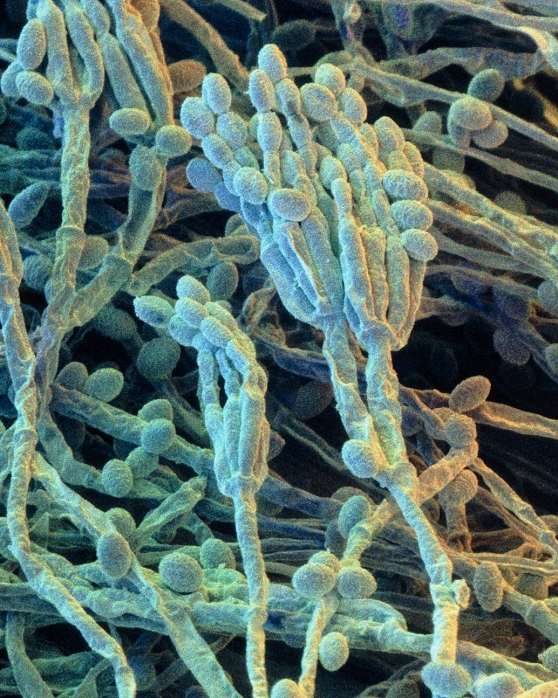 A type of blue green mold  Date of photograph unknown  Penicillium. Coloured Scanning Electron Micrograph  SEM  of the mycelium and fruiting bodies of the fungus Penicillium sp. Penicillin mould grows as a mycelium of hyphal threads, as seen here in the background. In the foreground  centre  is a hyphal branch which bears fruiting bodies at its tip, known as conidia. These tuft like clusters of conidia contain rounded spores strung together in chains. Once ripe each spore can germinate into a new fungus. Species of Penicillium are the source of antibiotic penicillin for use as drugs to combat bacterial infection. They are also used in the fermentation of roquefort   camembert cheeses. Magnification: x 1165 at 6x7cm size. x1,865 at 4x5ins