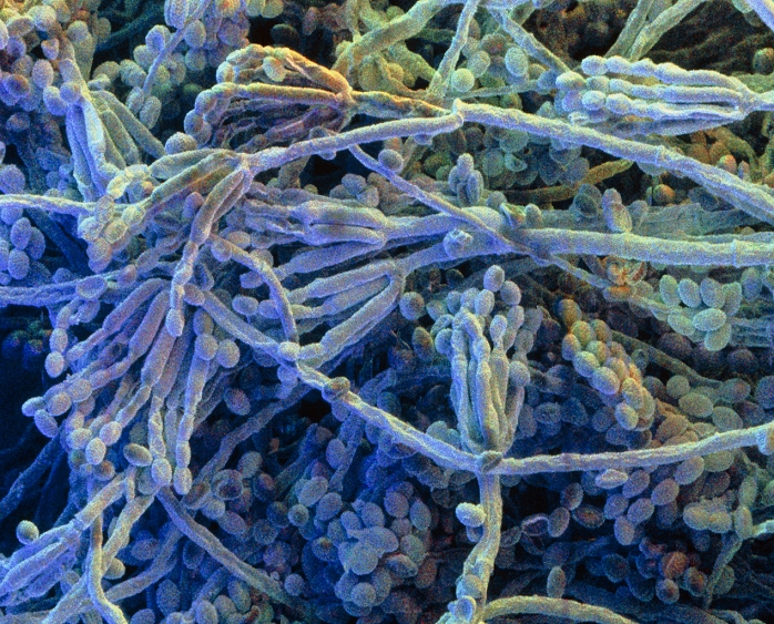 A type of blue green mold  Date of photograph unknown  Penicillium. Coloured Scanning Electron Micrograph  SEM  of the mycelium and fruiting bodies of the fungus Penicillium sp. Penicillin mould grows as a mycelium of hyphal threads, as seen here, many of which have developed into fruiting bodies. The fruiting bodies, known as conidia, are tuft like clusters at the tips of hyphae which contain rounded spores strung together in chains. Once ripe each spore can germinate into a new fungus. Species of Penicillium are the source of antibiotic penicillin for use as drugs to combat bacterial infection. They are also used in the fermentation of roquefort and camembert cheeses. Magnification: x600 at 6x7cm size. x970 at 4x5ins
