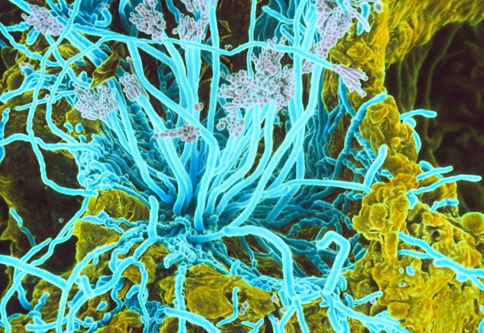 A type of blue green mold  Date of photograph unknown  Penicillium on bread. Coloured scanning electron micrograph  SEM  of the hyphae and fruiting bodies of the fungus Penicillium sp. seen growing as mould on bread. The fruiting bodies, known as conidia, are tuft like clusters at the tips of the thread like hyphae. These contain rounded spores strung together in chains. Once ripe each spore can germinate into a new fungus. Species of Penicillium are the source of the antibiotic penicillin. Magnification: x194 at 5x7cm size. Magnification  x680 at 8x10 ins size.