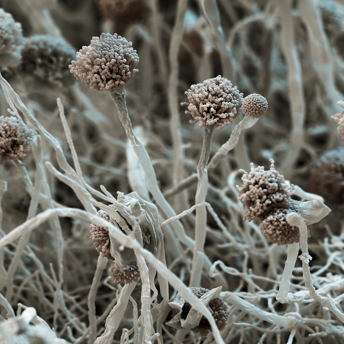 Aspergillus fungus. Coloured scanning electron micrograph (SEM) of the fungus Aspergillus fumigatus. The fungus is made up of fungal threads (hyphae, grey) with conidiophores (fruiting bodies, brown) at the tip. The conidiophores are made up of chains of conidia (spores), which are dispersed on the wind. Inhalation of spores by people with a weakened respiratory system, for example asthmatics or those with cystic fibrosis, leads to an allergic reaction known as aspergillosis. A. fumigatus usually grows on decomposing organic matter. Magnification: x430 when printed at 10cm wide.