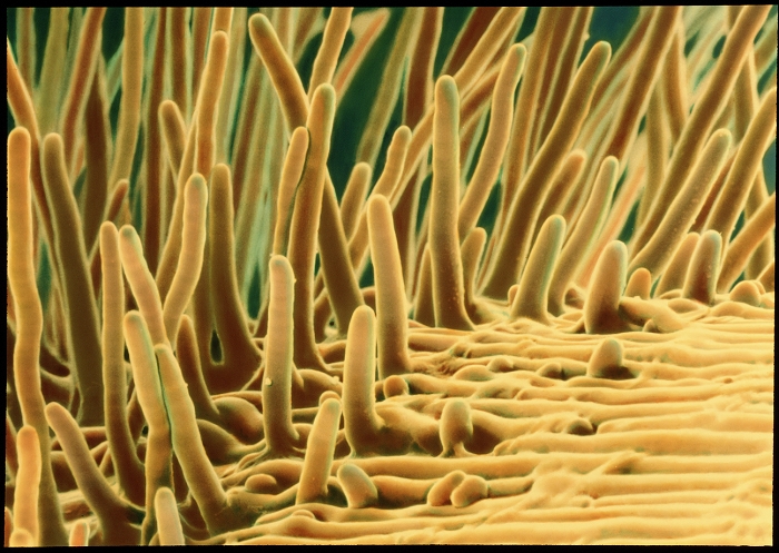 Root hairs. Coloured Scanning Electron Micrograph (SEM) of root hairs from a cress root. Root hairs form an intimate contact with the soil particles, and enormously increase the root's absorbing surface area. The Cress family (Cruciferae) includes about 2, 000 species of annual and perennial herbs. They are found in many kinds of habitats and are mainly northern temperate. The family includes greatly important food crops including the turnip, cabbage, cauliflower, radish, watercress and mustard. Magnification: x200 at 5x7cm size.