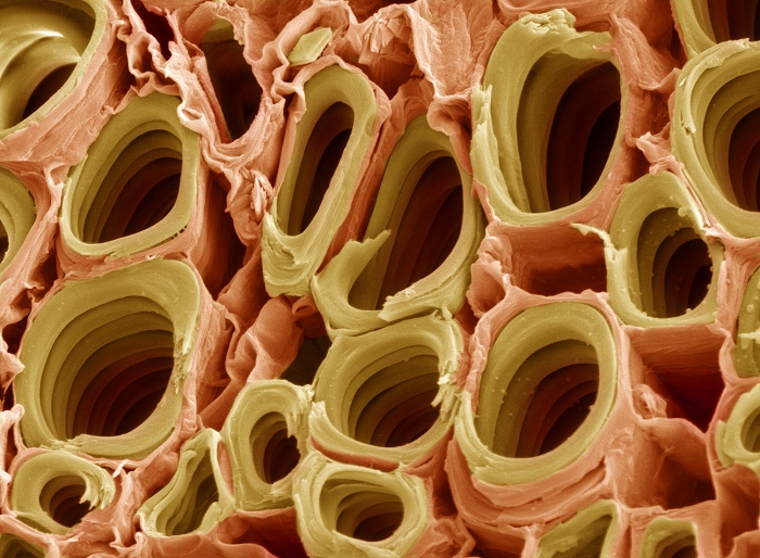 Xylem plant cells. Coloured scanning electron micrograph (SEM) of xylem cells from a sage stem (Salvia officinalis). The xylem transports water and mineral nutrients from the roots throughout the plant. The walls of the xylem vessels are strengthened with lignin (yellow), a woody substance that helps to support the plant.