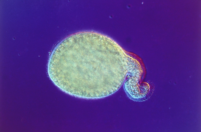 Light micrograph of a germinating pollen grain of the lily Lilium (Liliaceae). Once this pollen, which contains the male gametes, has landed on the female stigma of the flower, it germinates. A tube (seen here) grows out from the pollen grain, down through the stigma to the ovary. The male nuclei pass down this tube, fertilize the ovules and a seed is formed. Magnification: x400 at 35mm size.
