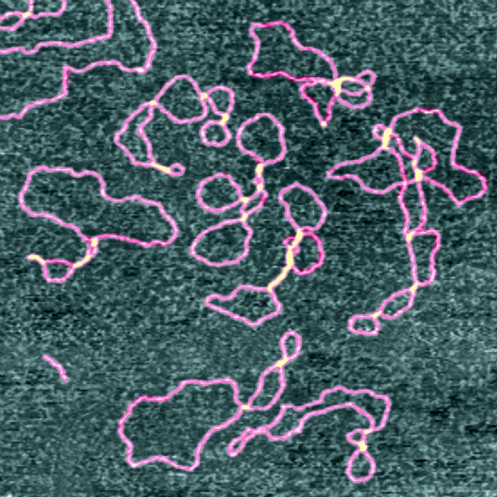 Drug-DNA complexes. Coloured atomic force micrograph (AFM) of plasmids (pink) of DNA (deoxyribonucleic acid) bound to the anti-cancer drug ditercalinium. This drug distorts the shape of DNA, which eventually causes the death of affected cells. Distorted regions are yellow here. Plasmids are loops of DNA found in some bacteria and yeast cells that exist separately from the cells' chromosomal DNA. They are able to replicate and express their genes independently, and are widely used in genetic research and engineering. Atomic force microscopy produces an image by moving a sensitive tip over a surface. Magnification: x75,000 at 6x6cm size.