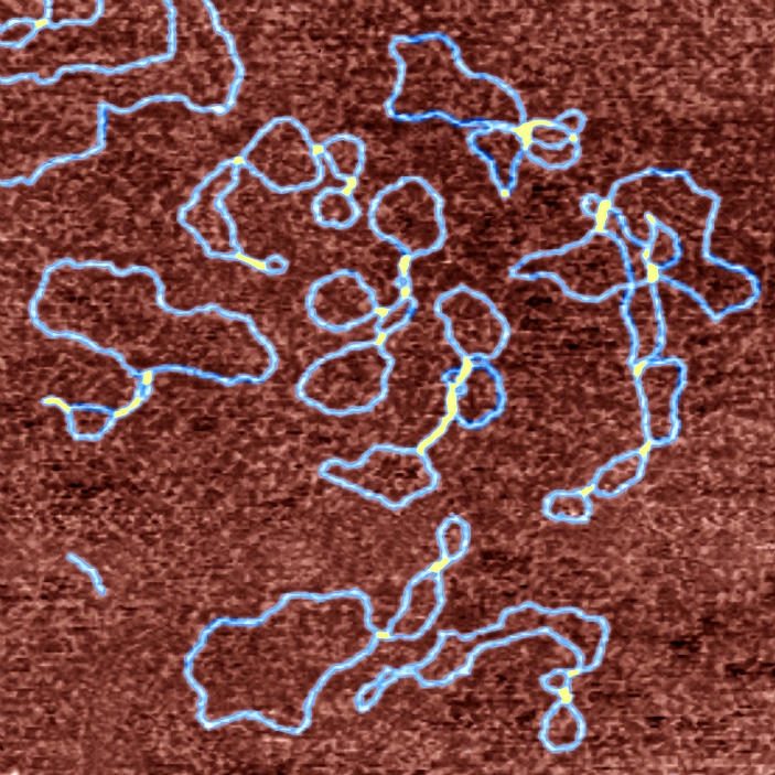 Drug-DNA complexes. Coloured atomic force micrograph (AFM) of plasmids (blue) of DNA (deoxyribonucleic acid) bound to the anti-cancer drug ditercalinium. This drug distorts the shape of DNA, which eventually causes the death of affected cells. Distorted regions are yellow here. Plasmids are loops of DNA found in some bacteria and yeast cells that exist separately from the cells' chromosomal DNA. They are able to replicate and express their genes independently, and are widely used in genetic research and engineering. Atomic force microscopy produces an image by moving a sensitive tip over a surface. Magnification: x75,000 at 6x6cm size.
