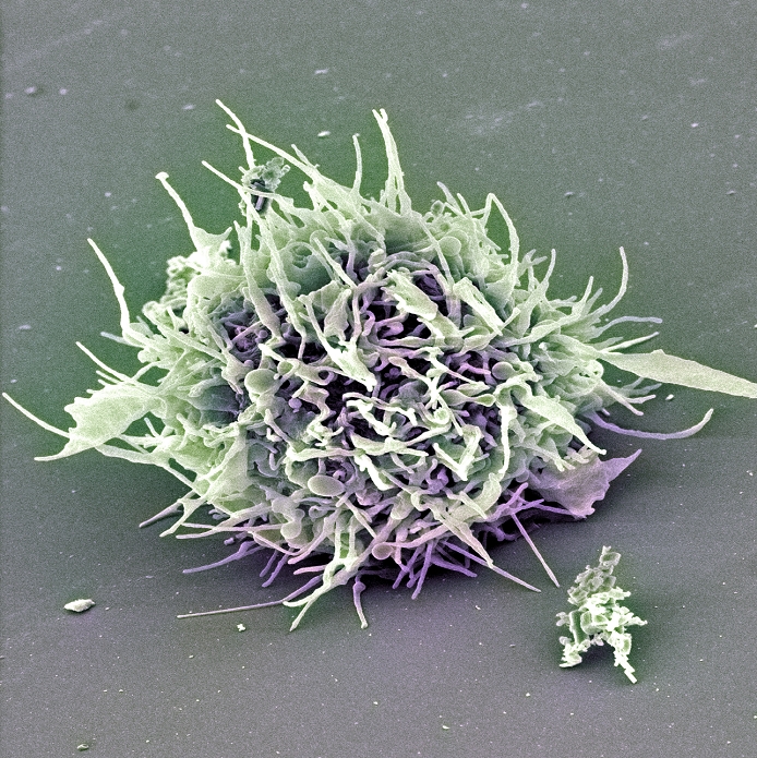Stem cell coloured scanning electron micrograph (SEM). These cells are known as multipotent because they undergo differentiation to produce precursors of all the body's specialised blood cells. By this process, termed haemopoiesis, stem cells develop either into red blood cells, or one of several types of white blood cells that make up the immune system. The purification of stem cells from umbilical cord blood allows scientists to research the function of the immune system and to develop treatments for diseases such as AIDS and leukaemia. Although this research is controversial. Magnification unknown.