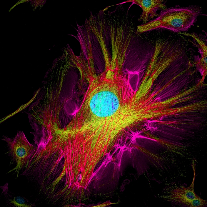 Cell structure. Confocal light micrograph of cultured endothelial cells. A fluorescent dye has been used to show the cell structure. Nuclei (blue) contain the cell's genetic information, DNA (deoxyribonucleic acid) packaged in chromosomes. Actin filaments (yellow) and tubulin (red and pink), which forms microtubules, part of the cell cytoskeleton are also seen. The cytoskeleton is responsible for intracellular transport, structure and motility of the cell, as well as segregating the chromosomes during nuclear division. Actin is the most abundant cellular protein. Endothelial cells are flat and line all of the body's blood vessels.