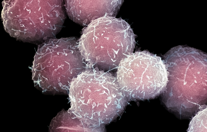 Stem cells, coloured scanning electron micrograph (SEM). Stem cells can differentiate into any other cell type. There are three main types of mammalian stem cell: embryonic stem cells, derived from blastocysts; adult stem cells, which are found in some adult tissues; and cord blood stem cells, which are found in the umbilical cord. The cells seen here are destined to become blood cells. During blood cell development in adults, stem cells develop through a process known as haemopoiesis. Blood cells have short lifespans and are therefore constantly produced by the bone marrow.