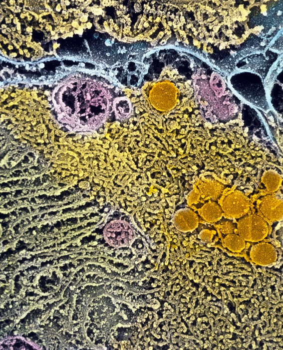 Leydig cell of testis. Coloured Scanning Electron Micrograph (SEM) of endoplasmic reticulum in a Leydig cell of a 14 week human foetus. Leydig cells produce steroids in the male testis. Here, endoplasmic reticulum (ER) membranes fill most of this secretory cell. Smooth ER is yellow; rough ER (green) is dotted with ribosomes involved in protein synthesis. The synthesis of lipids and steroids occurs within the lumen of these paired ER membranes. Lipid droplets are the round orange structures. Mitochondria (pink) produce chemical energy; the cell membrane is coloured blue. Magnification: x8,100 at 6x7cm size. x10,400 at 4x5ins