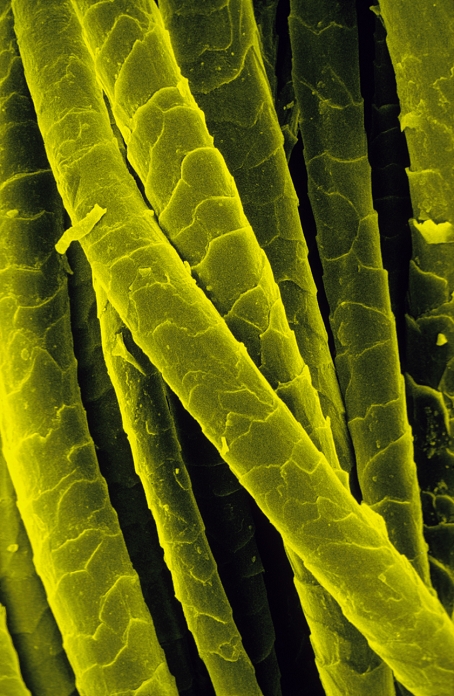 False colour scanning electron micrograph of Shetland wool taken from a knitted pullover. Wool is the hair of sheep & reveals a similar structure as human hair. The cuticle or outer layer (visible here) is scaly. Beneath this is the cortex, the bulk of hair & which contains hair pigments. At the centre is the medulla, which may be hollow. Hair cells are dead except for a layer at the base of the root. Cells here continue to divide forming new cells while pushing the older ones upward. Wool serves as a protection against inclement weather. Magnification: X143 at 35mm size,& X1000 at 10X8 inch size. Original is BW print H120/038