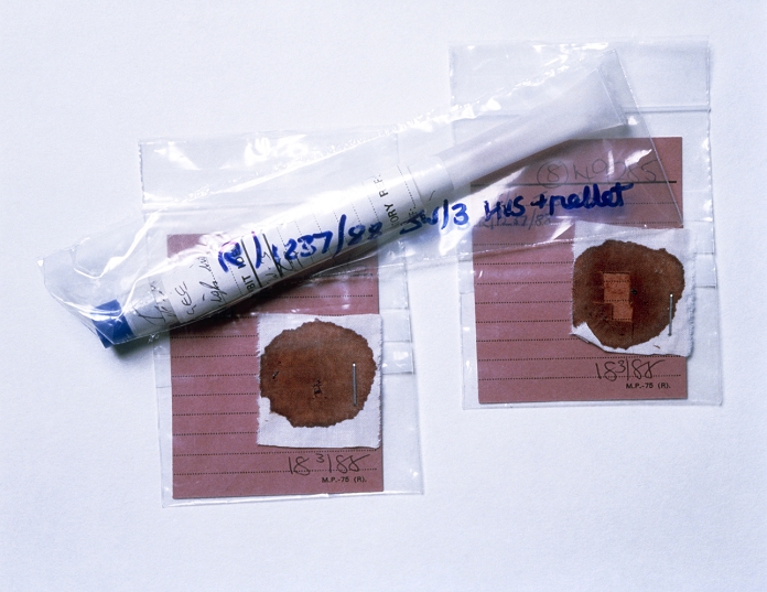 Two pieces of bloodstained cloth and a vaginal swab from which a DNA fingerprint was obtained in the investigation of a rape case. DNA taken from such samples can be used to produce a pattern of DNA bands - the DNA fingerprint - that is unique to an individual. If a suspect's DNA fingerprint, obtained from his blood sample, matches the DNA fingerprint obtained from a bloodstain at the scene of a rape, or from the semen found on a vaginal swab, his connection with the victim is proved beyond doubt. humans is one of the major applications of the DNA fingerprinting technique discovered in 1984 by Prof. Alec Jeffreys of Leicester University.