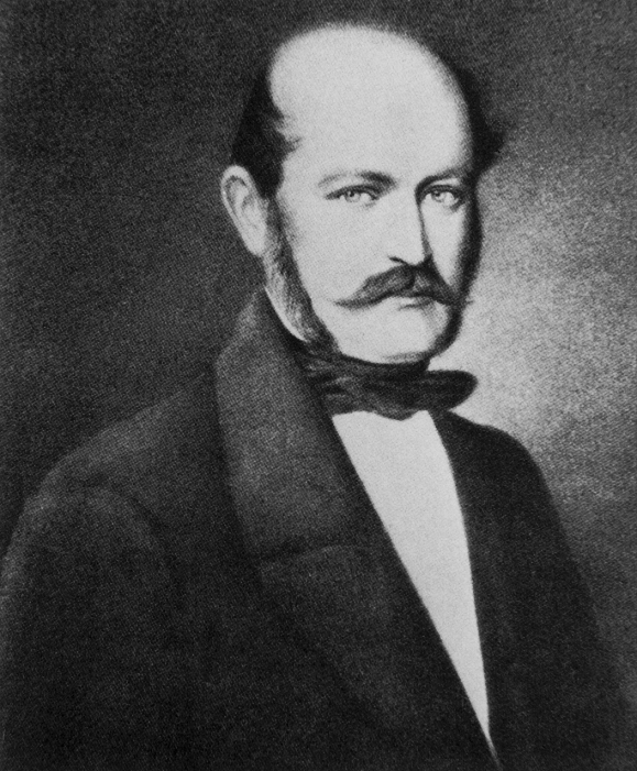 Ignatz Semmelweis  unknown date  Ignaz Phillip Semmelweis  1818 1865 , Hungarian physician   pioneer in the treatment of sepsis. As a specialist in obstetrics at the General Hospital in Vienna, Semmelweis noted that the mortality in pregnant women due to puerperal  childbirth  fever was 3 times higher in clinics staffed by medical students than those staffed by midwives. Deducing that an infectious agent was being carried from the dissecting rooms, he insisted that staff wash their hands in disinfectant, drastically reducing the mortality. However his ideas were not popular and it was only after Lister s success with anti  septic surgery that they were adopted.