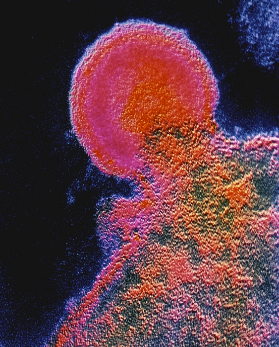 False-colour transmission electron micrograph (TEM) of HIV-1, the AIDS virus, budding from the surface of an infected T-lymphocyte. The emergence of a single virus particle (virion) is seen here. HIV binds to receptors of the T-cell's membrane & injects its genetic material (as RNA) into the cytoplasm. The host cell's DNA is subverted in the process of replication: viral progeny bud from the T-cell, which is damaged & eventually dies. Decline in T-cell count severely compromises the immune system, exposing the host to a range of opportunistic infections. Magnification: x55,000 at 6x7cm size.