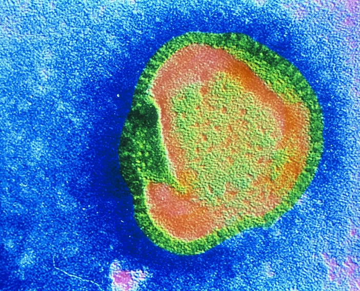 False-colour transmission electron micrograph (TEM) of a single virion (particle) of the influenza virus. The influenza virus belongs to the orthomyxovirus class of RNA viruses (the influenza viruses group), all of which possess an affinity for mucous. Spikes projecting from the viral envelope (just visible here) become attached to receptors on the surface of the host cells of the respiratory epithelium - the mechanism of the first stage of infection. Influenza is usually short-lived & generally not serious, although virus-induced pneumonia or secondary bacterial infection can prove fatal. Magnification: x400,000 at 6x7cm size.