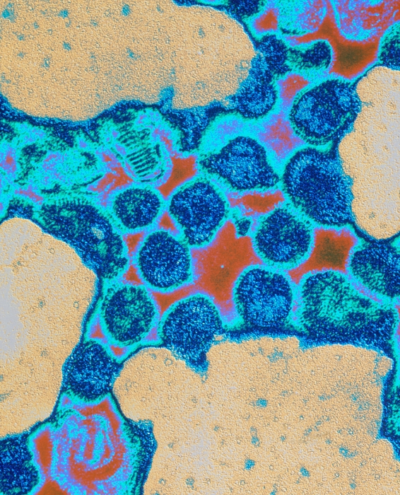 Influenza A virus. Coloured Transmission Electron Micrograph (TEM) of a cluster of influenza (flu) type A viruses. Influenza A is a contagious ortho- myxovirus, more virulent than influenza type B. At centre the viruses (blue) appear rounded but their shape is variable. Tiny spikes on the protein coat of the viruses are seen. These spikes stick to host cells when the virus invades the body. The virus has an affinity for mucus, and is spread in droplets from coughs or sneezes. Influenza symptoms include fever, chills and headache. The virus spikes may change structure to create new influenza strains that can spread as an epidemic. Magnification: x90,000 at 6x7cm size.