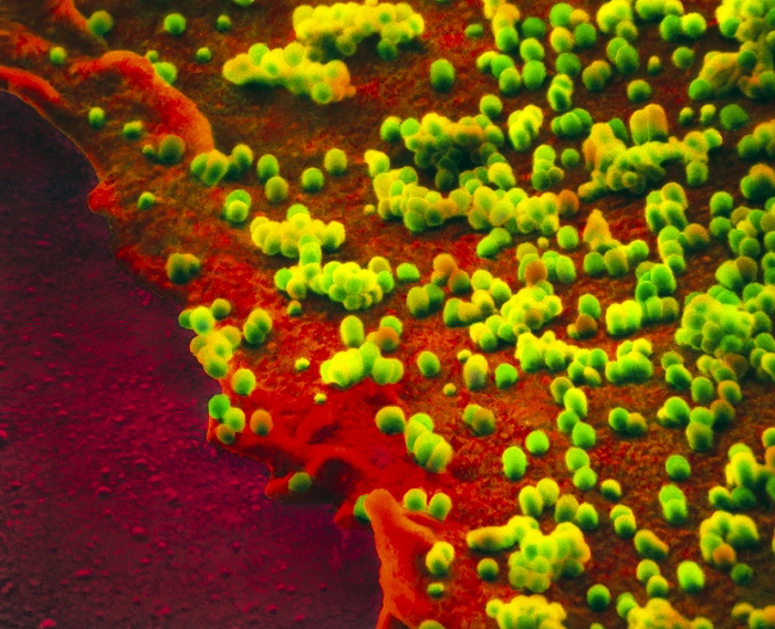 Influenza virus. Coloured scanning electron micrograph (SEM) of influenza viruses (green), a cause of human influenza, on the surface of a culture cell (orange). This virus belongs to the orthomyxovirus class of RNA viruses, all of which possess an affinity for mucus. The viruses are surrounded by a protein envelope and covered with specialised molecules called glycoproteins. These attach to the mucoprotein receptors on the surface of host cells of the respiratory epithelium. Influenza is usually short-lived and is seldom serious. This is the Neurotrophic Wilson-Smith (NWS) strain and it is H1N1. Magnification: x14,000 at 6x7cm size. Magnification: x46,000 at 8x10 ins size.