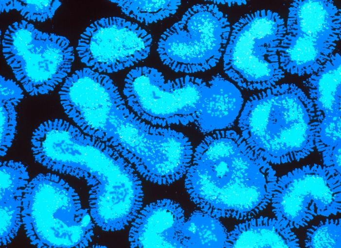 Influenza viruses. Coloured transmission electron micrograph (TEM) of a section through influenza (flu) viruses. Flu viruses are orthomyxoviruses, made up of a core of RNA (ribonucleic acid) in a protein coat which is surrounded by an outer spiked envelope (dark blue). The protein spikes stick to host cells in the infected body. This contagious virus has an affinity for mucus and is spread in droplets from coughs or sneezes. The antigen spikes can mutate and change form making the immune system ineffective and resulting in epidemics. To protect those at risk, new influenza vaccines must be prepared and given every year. Magnification unknown.