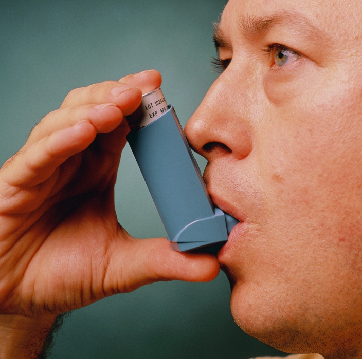. Asthma inhaler. Man using a pressurized aerosol Ventolin inhaler to control an attack of asthma. The Ventolin inhaler uses a drug called salbutamol which dilates the bronchial muscles, allowing air to pass to the lungs. In bronchial asthma an allergic reaction to particles in the air causes a spasm of the muscles in the bronchial tubes which narrows the airways. These spasms are associated with swelling of the lining surfaces and an increased production of secretions. MODEL RELEASED