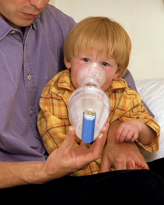 . Asthma treatment. Father helping his young (21-month-old) son to use a nebulizer. The nebulizer delivers fine droplets of a drug into the face mask for inhalation. The drug being used here is salbutamol, which is a bronchodilator (relaxes constricted air passages in the lungs). An electric or hand-operated pump sends a stream of air or oxygen across a chamber containing the drug, dispersing it into a mist. This is part of the boy's daily treatment, but nebulizers are also used in emergencies to treat severe acute asthma attacks. MODEL RELEASED