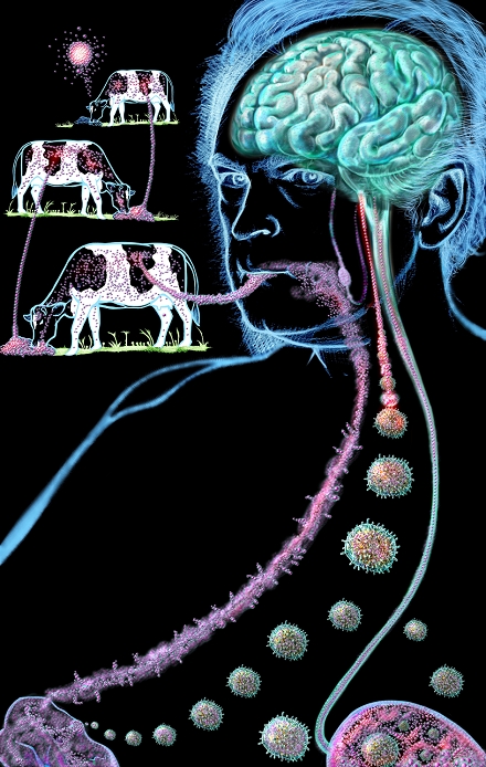 Prion spread. Artwork of a theoretical basis for the spread of prions from cows to humans. Prions are abnormal proteins that are the cause of transmissible spongiform encephalopathies (TSEs), such as BSE in cows, scrapie in sheep and CJD (Creutzfeldt-Jakob disease) in humans. They cause fatal brain and nerve degeneration. BSE prions (pink) spread as cows ate infected bovine material. Ingestion by humans led to prion uptake by lymphocytes (spiky balls, immune cells) in the gut and spleen (bottom left and right), going to the brain (upper right), causing new variant CJD. Prions are an abnormal shape of a normal protein, causing normal ones to flip to the abnormal shape.