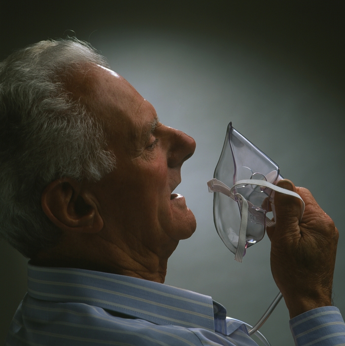 . Heart attack oxygen therapy. View of an elderly man holding an oxygen mask up to his face. He is suffering from breathlessness due to angina pectoris or a heart attack (myocardial infarction). The oxygen mask supplies him with air enriched with the oxygen he is lacking. Angina is a feeling of pain and constriction in the chest. It is caused by a blockage in one of the coronary arteries which supply the surface of the heart with oxygen. This can result in tissue death and a heart attack. Alternatively the man may be suffering from asthma or bronchitis which cause breathlessness due to inflammation of the lung's airways. MODEL RELEASED