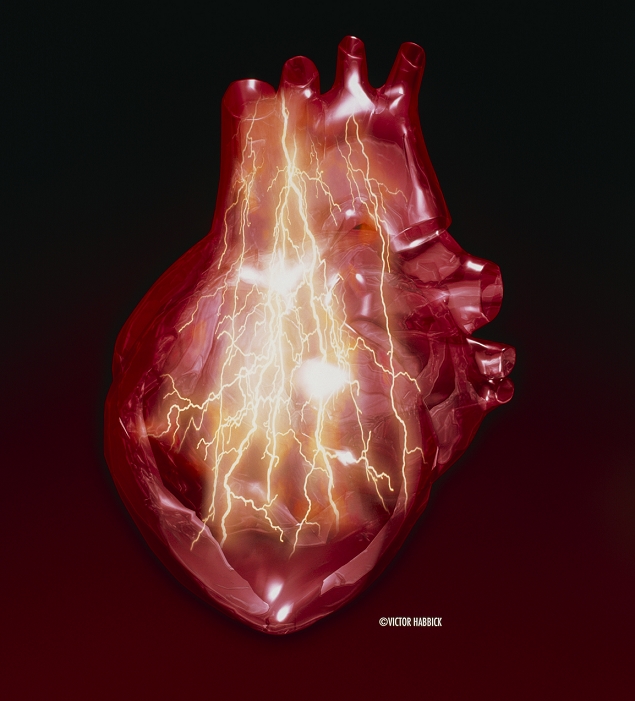Heart attack. Conceptual computer artwork of bolts of lightning on a heart, representing a heart attack (myocardial infarction). The heart (red) is a hollow sac of muscular tissue that pumps blood around the body. This muscle tissue is supplied with oxygenated blood by coronary blood vessels (not seen) that run over the surface of the heart. A blockage of these will deprive the heart tissue of oxygen, leading to the intense pain of a heart attack, damage or loss of heart function and often death. Restricted blood supply is commonly caused by vascular diseases such as atherosclerosis, where deposits of fat narrow blood vessels.