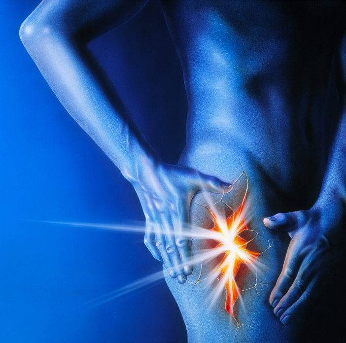 Thigh pain. Artwork of a man holding his thigh in pain. The painful area is shown split open and glowing orange. Leg pain may be caused by cramps in the leg muscles, inflammation of the sciatic nerve (sciatica) or deep vein thrombosis. Deep vein thrombosis occurs when a blood clot, or thrombus, forms within a vein. If this happens in the leg it may cause pain, swelling and skin ulceration.