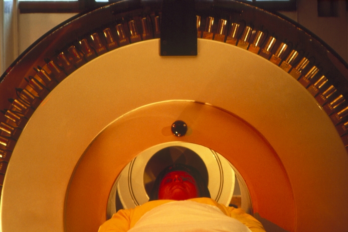Woman undergoing brain scan using Positron Emission Tomography (PET), showing her head surrounded by the circular scanner. A colour-coded PET scan is obtained by first injecting a positron-emitting radioisotope (produced in a cyclotron) into the bloodstream: the detector is sensitive to gamma rays produced when positrons emitted annihilate with electrons from the molecules in the brain (known as tracers) to which the radioisotope has been dedicated. Applications of PET include the use of radioactive oxygen to measure oxygen consumption in senile dementia, cerebrovascular disease and brain tumours.