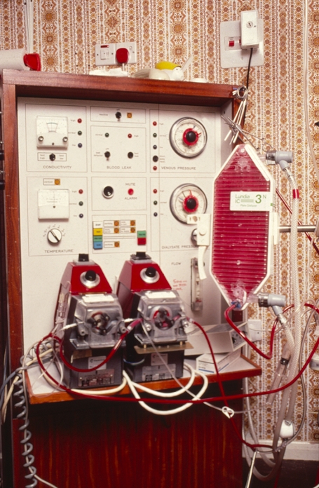 Kidney (haemodialysis) machine, used for the removal of waste materials from the bloodstream of a person whose kidneys function insufficiently. A stream of blood from an artery is circulated through the machine on one side of a semi- permeable membrane, while a solution of comparable electrolytic concentration circulates on the other side. Water & waste products pass across the membrane but blood cells & proteins are too large to do so. Purified blood is returned to the body through a vein. Circulating the blood is visible inside the plastic tubing.