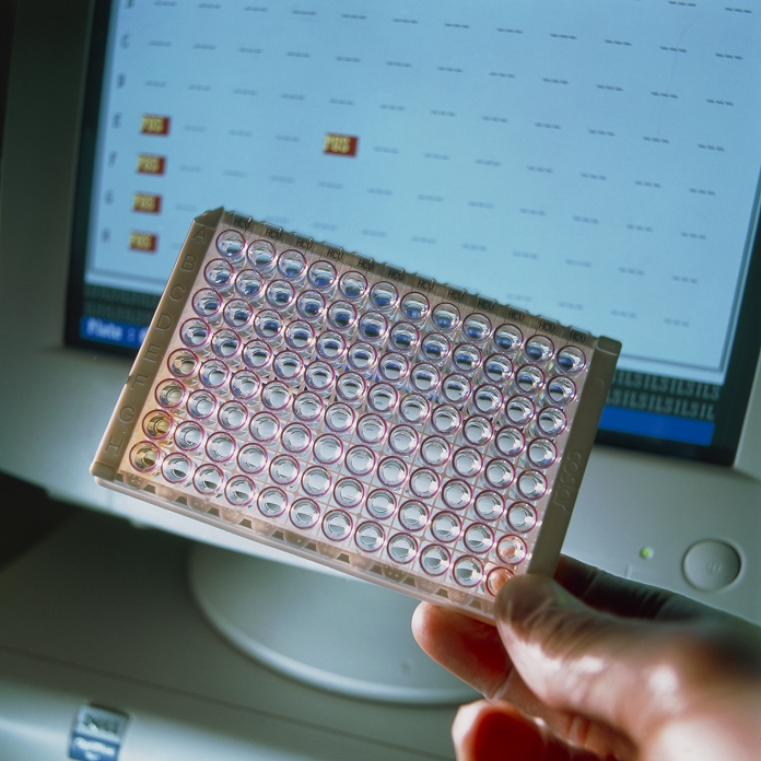 ELISA antibody test. Hand holding a multi-well sample tray in front of a computer monitor during an enzyme-linked immunosorbent assay (ELISA) antibody test. The ELISA test checks for antibodies to viral diseases, in this case hepatitis C. First, the patient's blood plasma is washed over a surface covered in the antigens of the virus being tested for. If antibodies are present then they will bind to these antigens. Next, peroxidase is added which binds to the antibodies. Then a chemical is added that changes colour when it comes in contact with peroxidase.