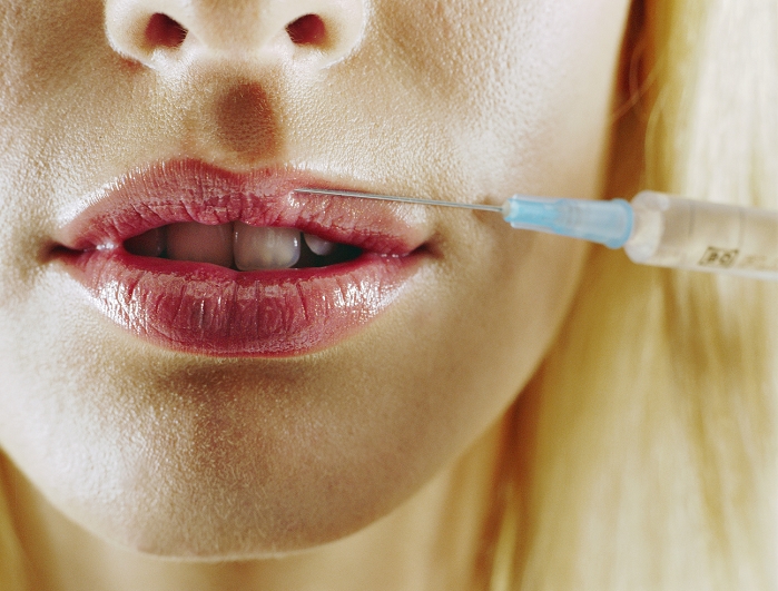 . Collagen injection. Woman holding the needle of a syringe filled with collagen to her upper lip. Collagen, the body's major structural protein, can be injected into and around the lips to produce a more prominent pout (lip augmentation). The collagen fills out the spaces beneath the skin, giving the lips a fuller appearance. The effects of this protein are only temporary. MODEL RELEASED