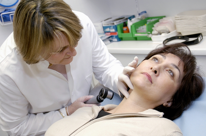 . Skin examination. Dermatologist examining an area of skin on woman's neck with a magnifier. MODEL RELEASED