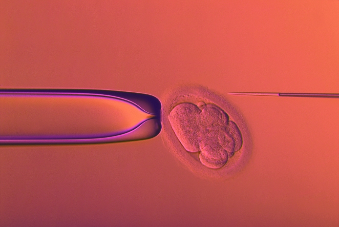Preimplantation diagnosis  1 4  IVF embryo testing  image 1 of 4 . Coloured light micrograph of an IVF human embryo during pre  implantation genetic testing. The 8 celled embryo  near centre  produced by in vitro fertilisation  IVF  in the laboratory is being manipulated in order to have one of its cells removed. A pipette  at left  holds the embryo. At right a micro  needle is first used to break through the embryo membrane, before a cell is removed with another pipette. The cell is genetically screened to check for disorders such as Down s syndrome. Once screened and found normal, this embryo will be implanted into the uterus  womb  wall. See photos M802 187 190 for sequence of this procedure.